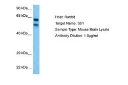 ST7L Rabbit anti-Mouse, Polyclonal, Novus Biologicals 0.1 mL | Buy Online | Novus Biologicals | Fisher Scientific